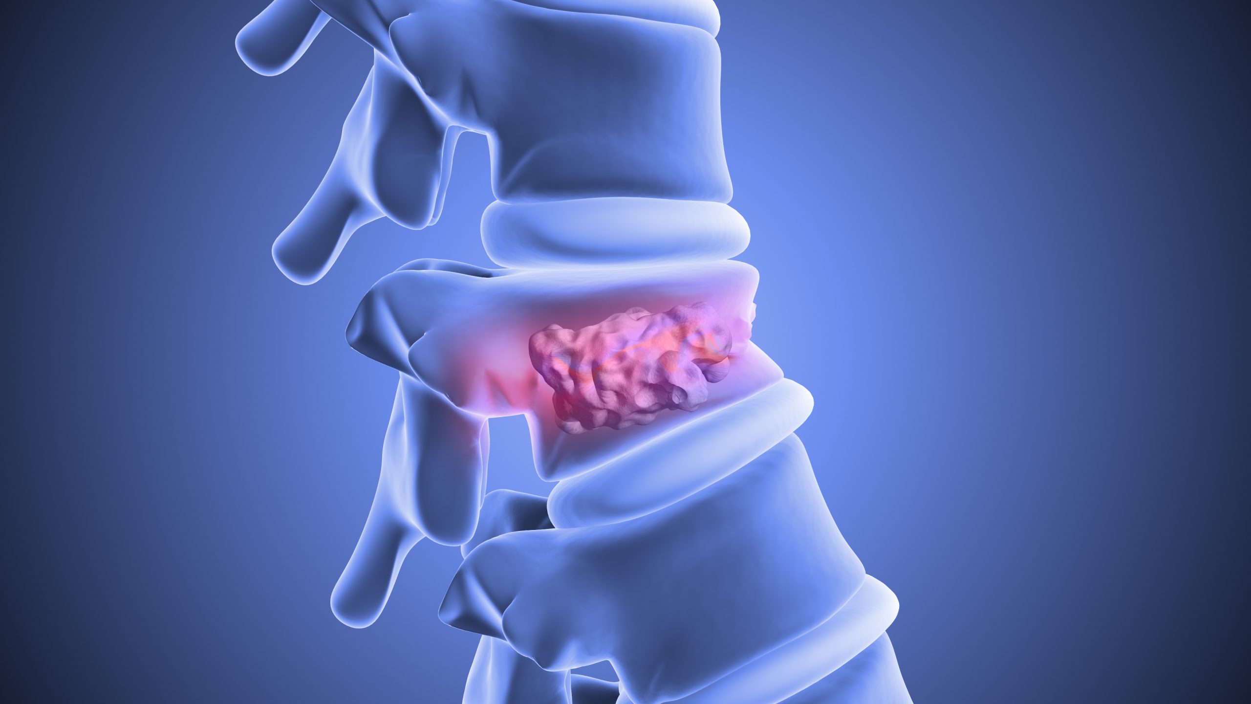 Spinal Cord Injury Treatment Dubai